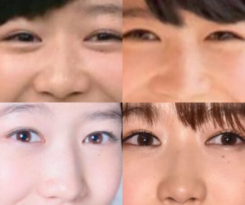 岡本夏美の鼻