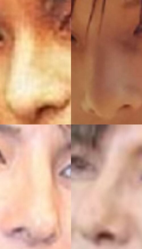 松岡充の鼻