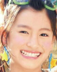 森高愛が整形か画像比較｜注目は「目」「鼻」
