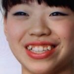 紀平梨花が整形か画像比較｜注目は「目」「鼻」「顎」