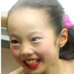 本田真凜が整形か画像比較｜注目は「目」「鼻」「顎」