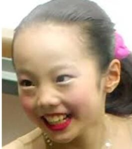 本田真凜が整形か画像比較｜注目は「目」「鼻」「顎」