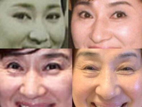 松居一代の鼻