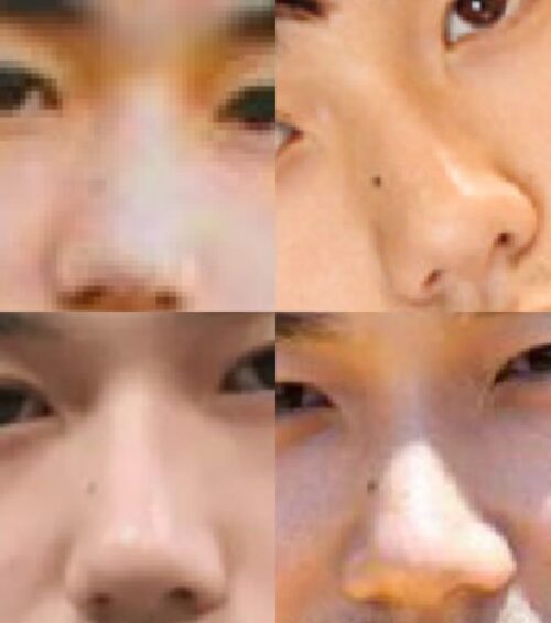 松山ケンイチの鼻