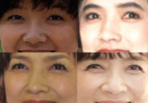 榊原郁恵の鼻
