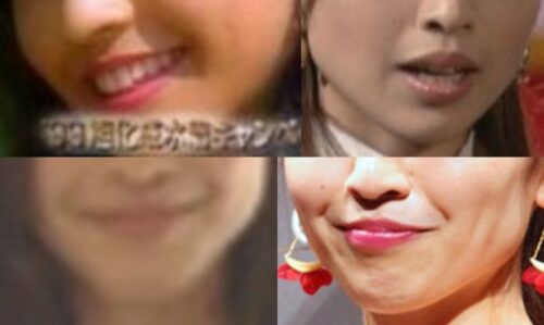 片瀬那奈の口