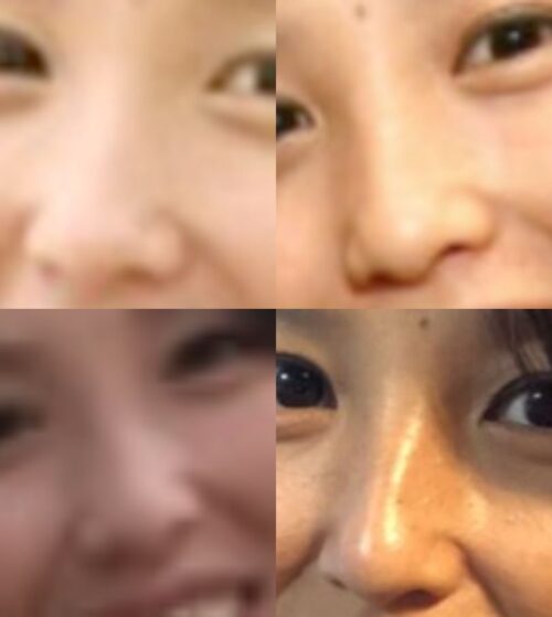 若林史江の鼻