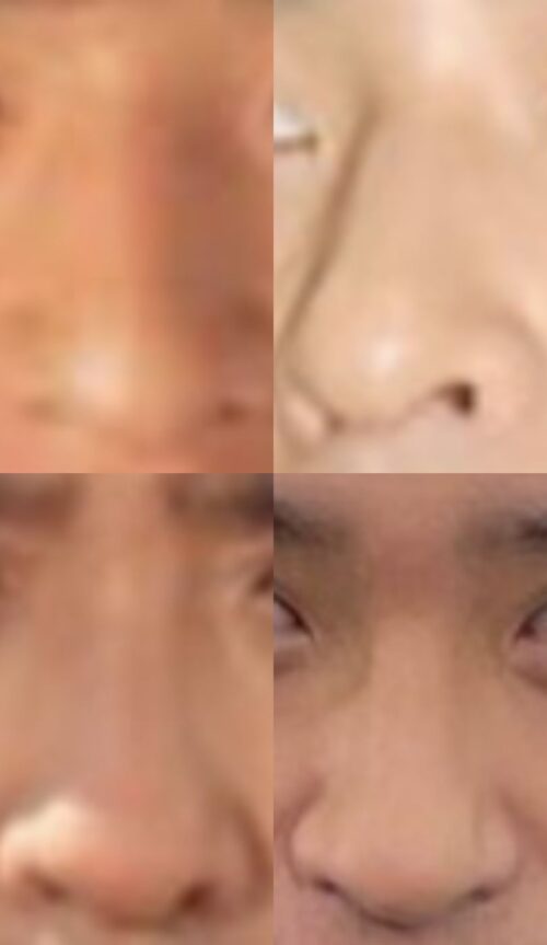 賀集利樹の鼻