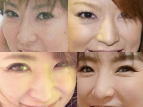 星野加奈の鼻