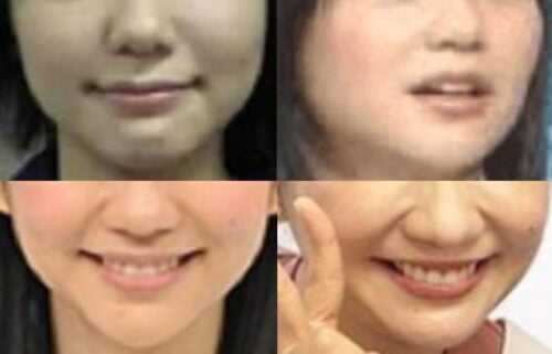 関根麻里の口