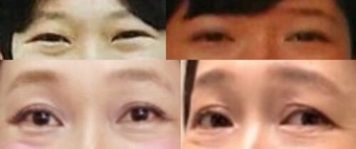 虻川美穂子の目