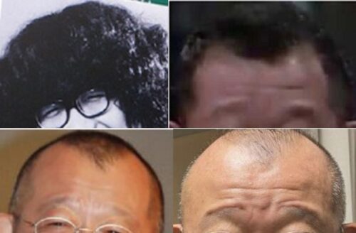 笑福亭鶴瓶のおでこ