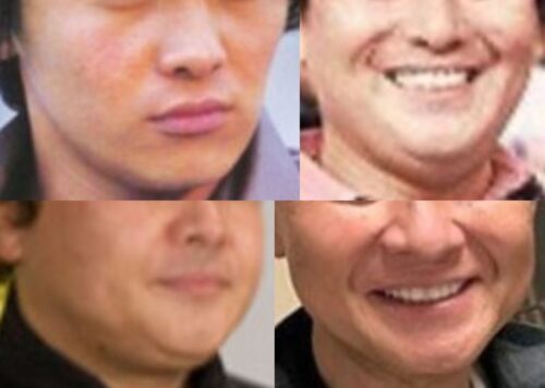 渡辺徹の口
