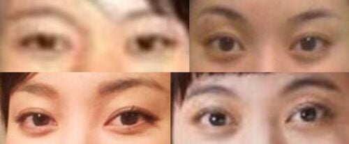 鈴木杏の目