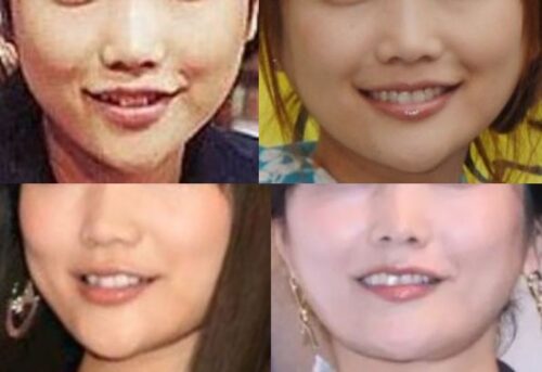 佐藤江梨子の口