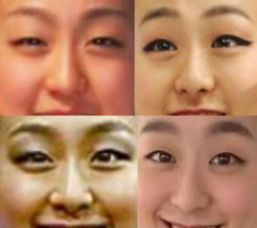 浅田真央の鼻