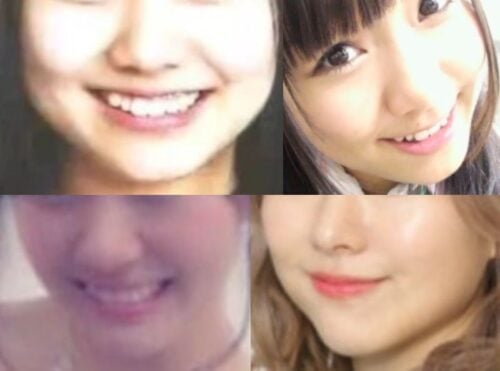 須田亜香里の口