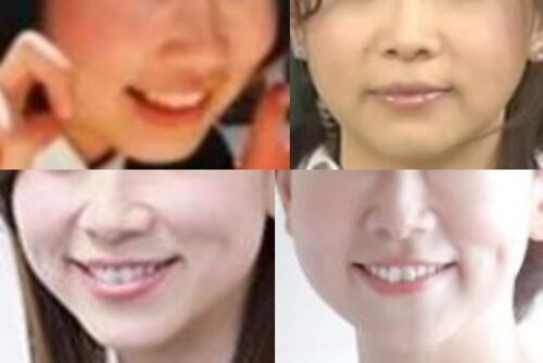 松尾翠の口