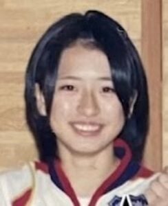 NICO(平成フラミンゴ)が整形か画像比較　注目は「目」、「鼻」