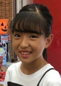 みなみ(YouTuber)が整形か画像比較　注目は「目」、「鼻」